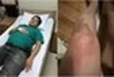 NSƯT Chí Trung mắc bệnh lạ