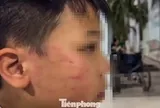 Tin mới vụ giáo viên người nước ngoài tát vào mặt học sinh