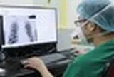 AI đọc phim X-quang, giám định bảo hiểm y tế: Bác sĩ có bị thay thế?