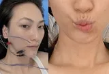 Nữ chính phim trăm tỷ của Trấn Thành: Từng đi bán xôi lề đường, bị biến chứng sau ca mổ tuyến giáp