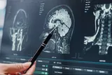 Cú đập bóng chày vào đầu biến cậu bé thành hiện tượng thiên tài khiến giới khoa học kinh ngạc