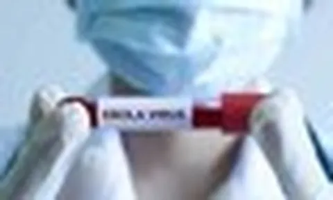 Bệnh Ebola tử vong đến 90%, Bộ Y tế ra chỉ đạo khẩn, yêu cầu cách ly nghiêm ngặt