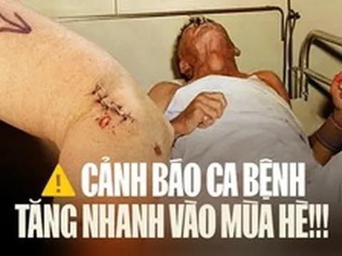 1 căn bệnh đang tăng mạnh, đã có 13 ca không qua khỏi chỉ trong 3 tháng đầu năm: Bác sĩ Bệnh viện Bạch Mai cảnh báo khẩn