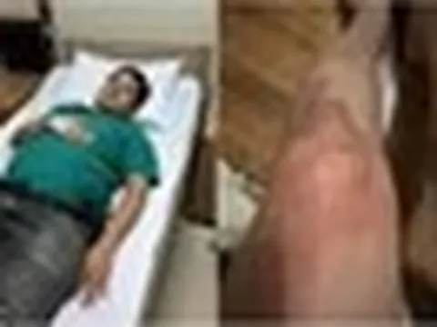 NSƯT Chí Trung mắc bệnh lạ