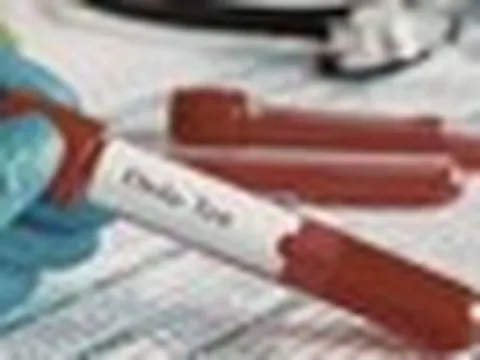TPHCM tăng cường giám sát cửa khẩu, chủ động phòng nguy cơ dịch bệnh Ebola xâm nhập